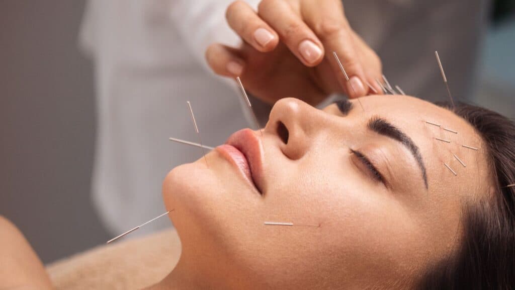 acupuncture Bentonville AR